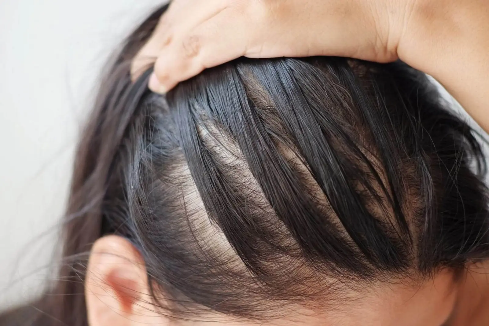 Woman showing thinning at her parting